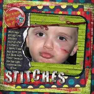 Stitches small